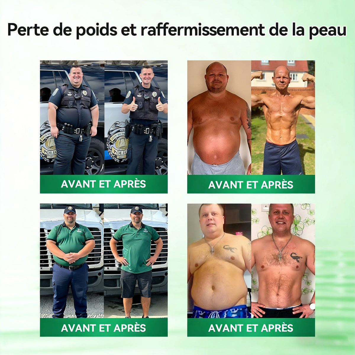 𝐌𝐑𝐄𝐕𝐁𝑺𝑰𝑵®  𝐏𝐚𝐭𝐜𝐡 𝐦𝐢𝐜𝐫𝐨𝐧𝐞𝐞𝐝𝐥𝐞 𝐧𝐚𝐧𝐨 𝟏𝟎-𝐞𝐧-𝟏 à 𝐥𝐚𝐫𝐠𝐞 𝐜𝐨𝐮𝐯𝐞𝐫𝐭𝐮𝐫𝐞 𝐚𝐦é𝐥𝐢𝐨𝐫é𝐞